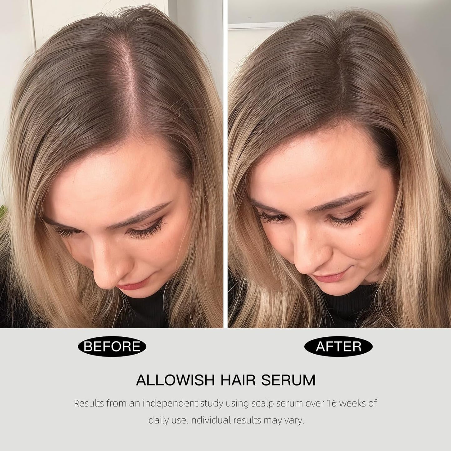 Hair Growth Serums 95 ml - Rosemary Hair Thickening Serum with Biotin, Caffeine for Hair Thinning & Shedding – Promotes Healthy Scalp, Fuller, Nourish, Strengthens Roots