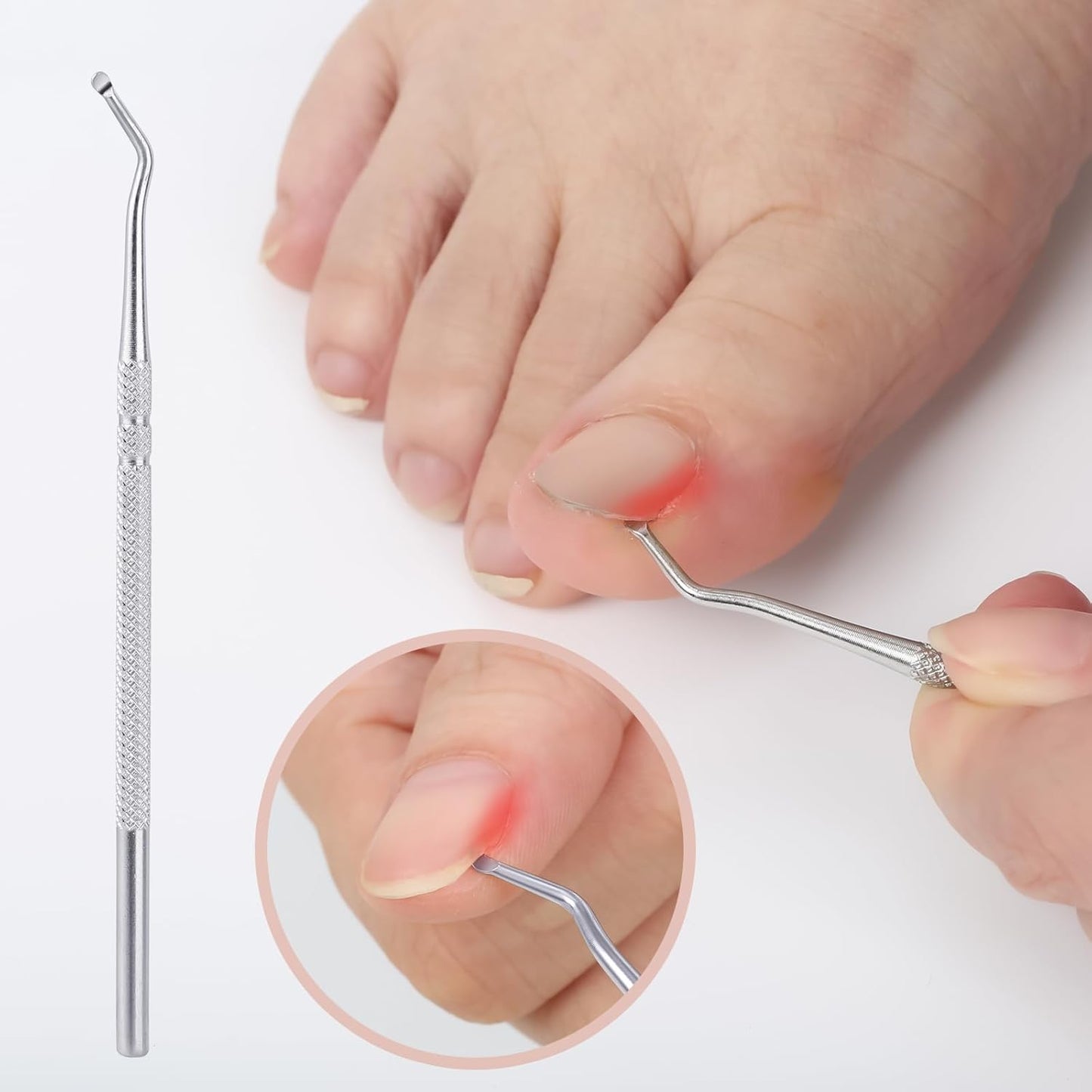 Stainless Steel Ingrown Toenail Pedicure Knife Set,Professional Foot Skin Scraper Repair Sharp Blade Kit For Nail Corn Callus Paronychia Treatment. (5)