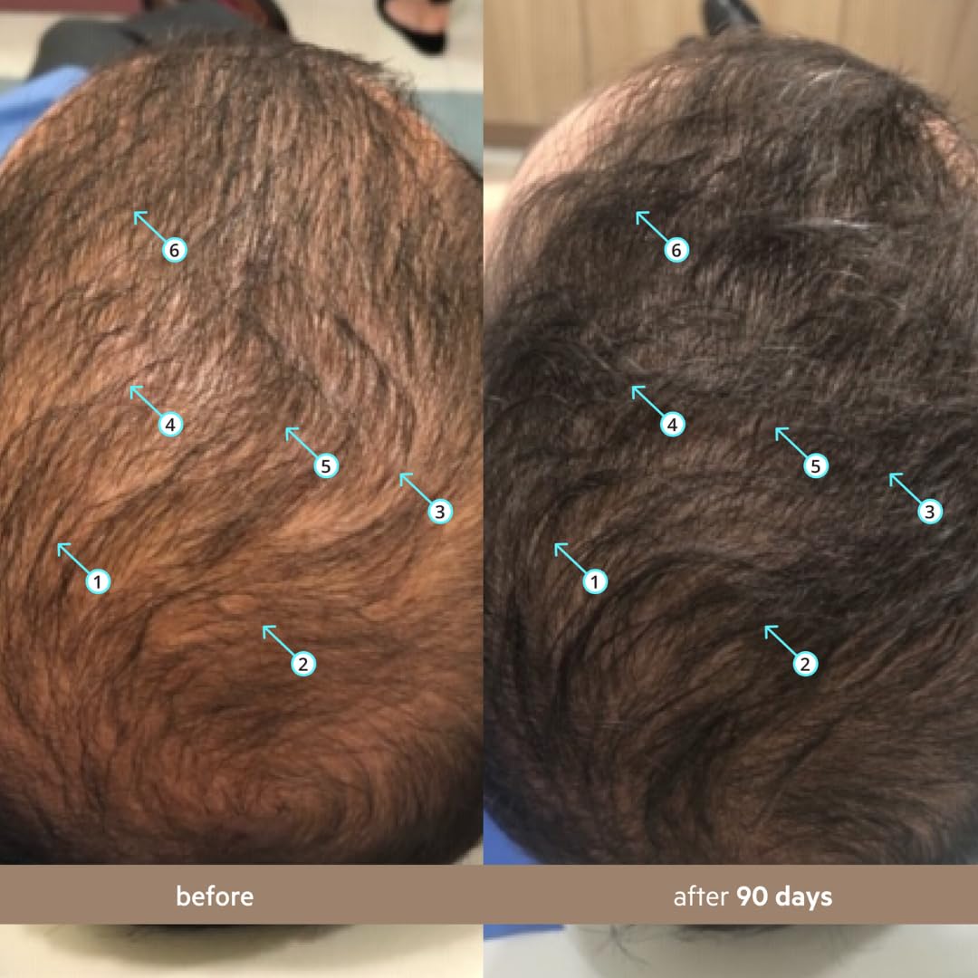 DS Labs Spectral Men’s Hair Density Serum (formerly Spectral.DNC-N), 60mL - Lightweight Leave In for Fuller Looking, Thicker Looking Hair, Fast Absorbing, Non-Greasy, For All Hair Types, (3 Pack)