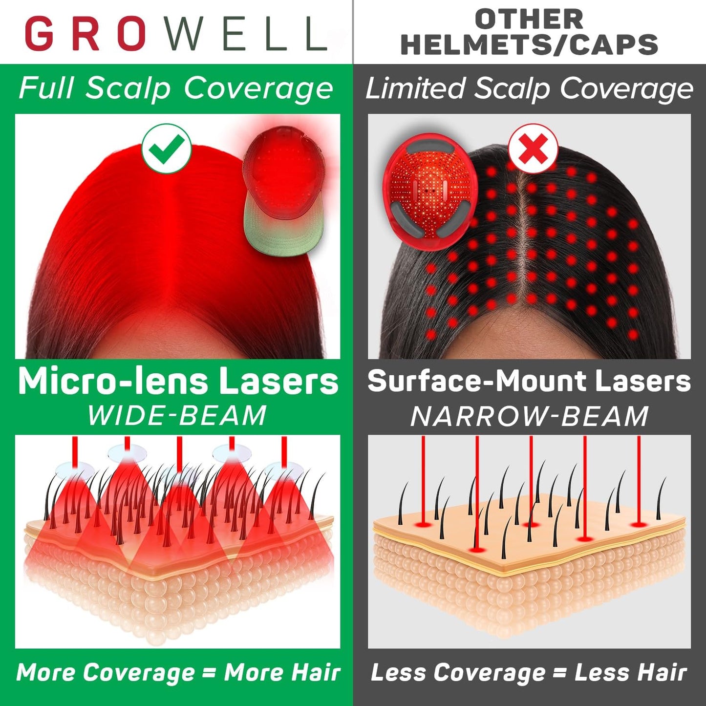GroWell Red Light Therapy Hair Growth Cap – FDA Cleared Laser Treatment for Hair Regrowth and Reduced Shedding – LED & Laser Red Light Therapy Clinically Proven in Double-Blind Studies -Green