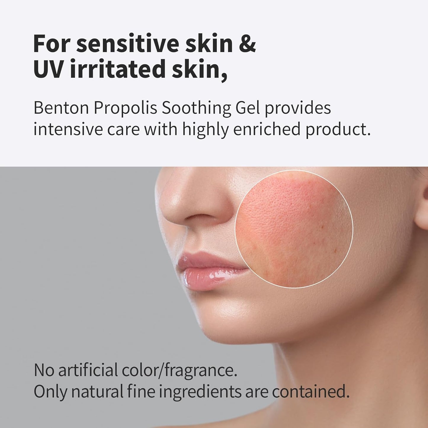 BENTON Aloe Propolis Soothing Gel 3.38 fl oz | Aloe Vera Gel for Sunburn Relief | Aloe Vera Gel for Travel Size | Aloe Vera Gel Moisturizer for Face | Aloe Gel for Face After Sun | Organic Aloe Vera