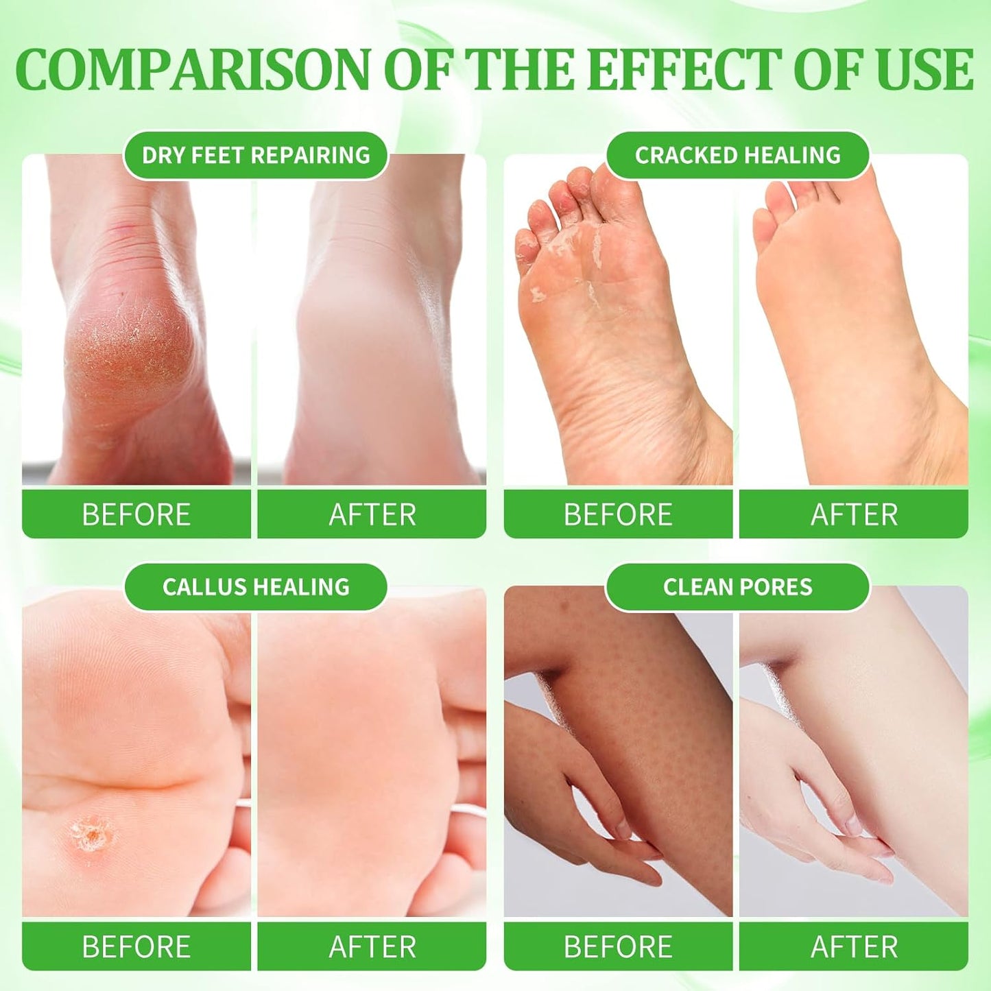 Pedicure Kit Foot Soak Set: Bubble Salt, Sugar Scrub, Massage Mask, Massage Lotion in a Box, 4 Step Foot Spa Kit for Dry Feet,Tired Feet（1 Set Lemon)