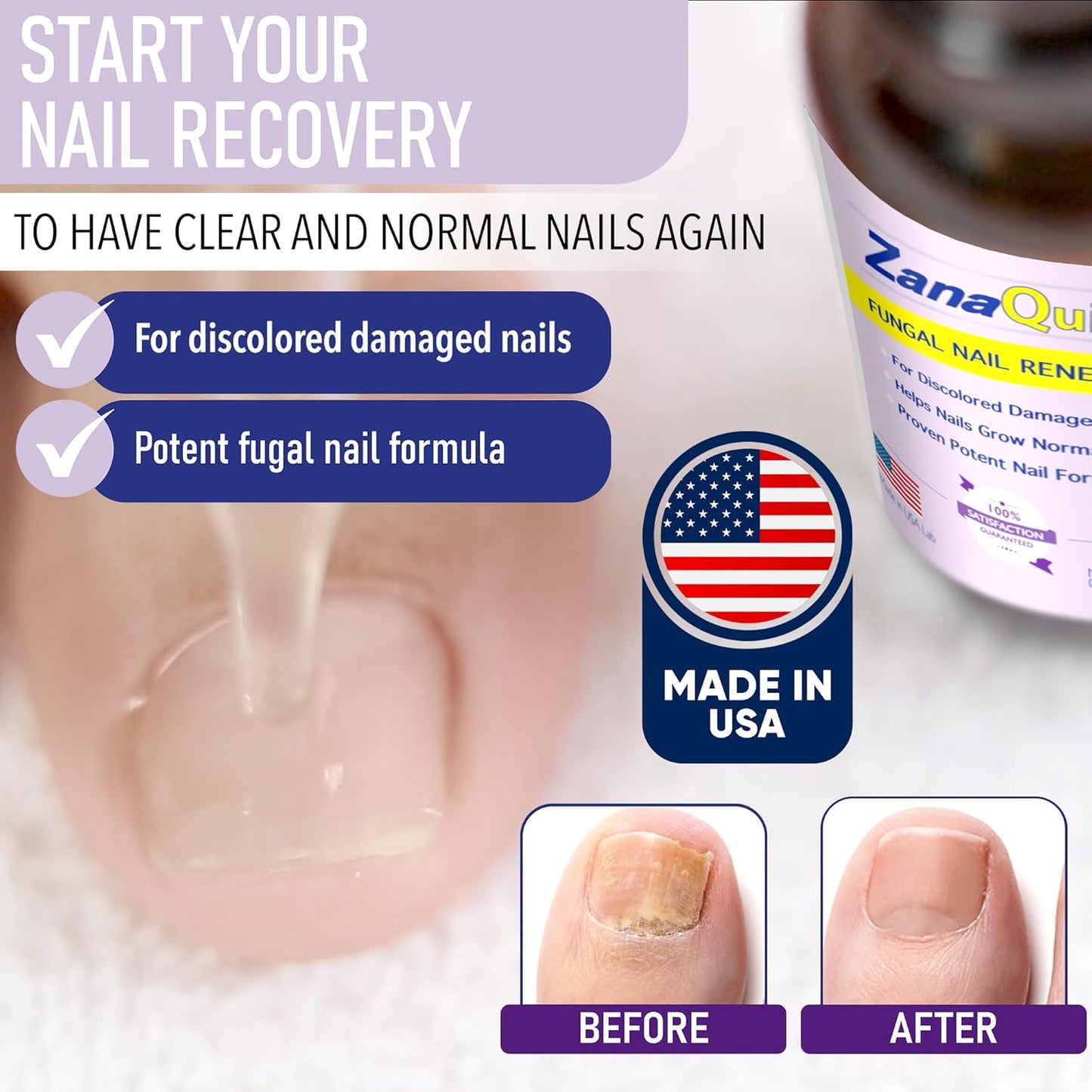ZanaQuick 2 Step Toenail Fungus Treatment. Extra Strength Damaged Nail Solution & Renewal Drops and Damaged Nail Disruptor – Repair Strategy Kit for Discolored Brittle Nails