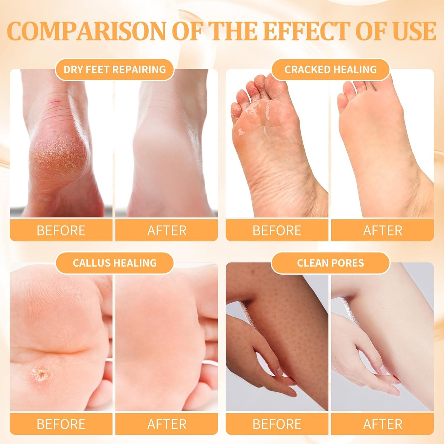 Pedicure Kit Foot Soak Set: Bubble Salt, Sugar Scrub, Massage Mask, Massage Lotion in a Box, 4 Step Foot Spa Kit for Dry Feet, Calluses and Tired Feet(1 Set Tropical Fruit)