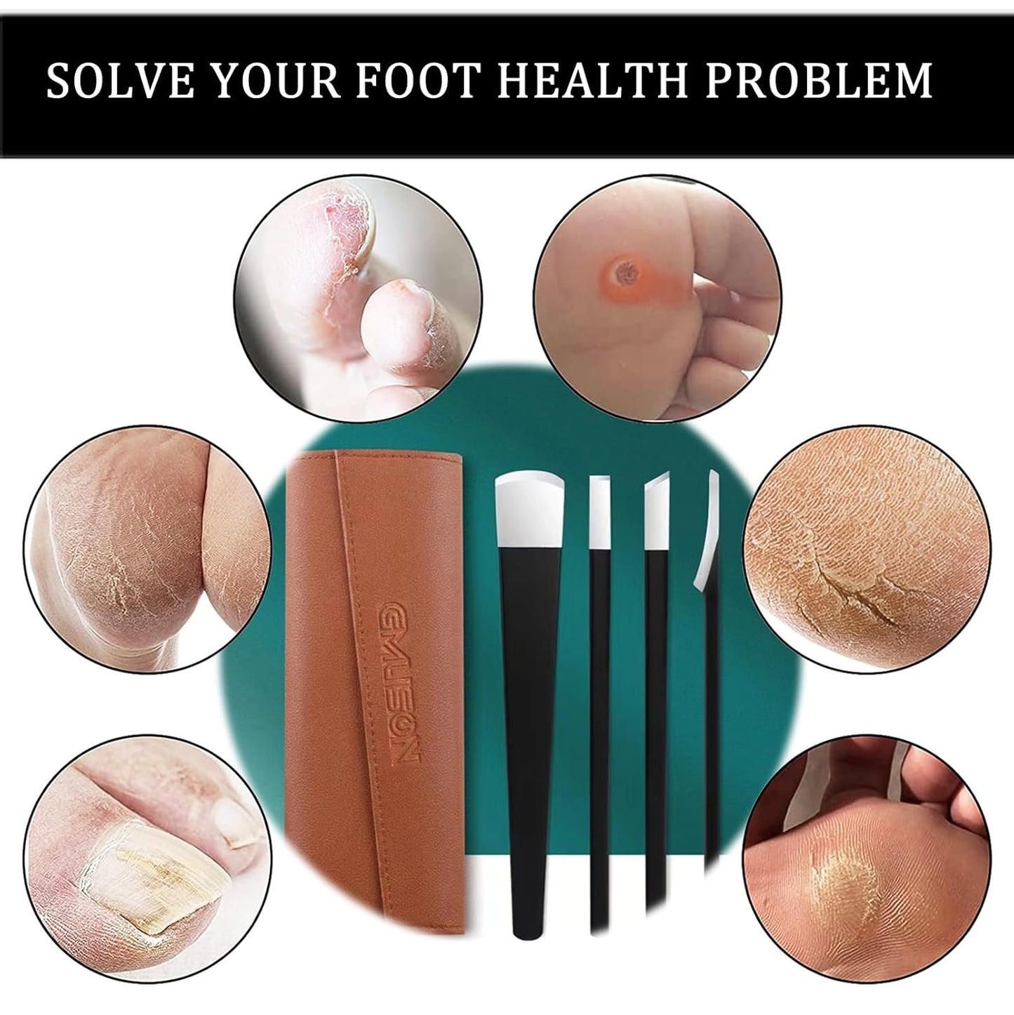 Professional Pedicure Knife Set Callus Knife for Feet Ingrown Toenail Knives Foot Care Tools Dead Skin Removal Nail Scraper File