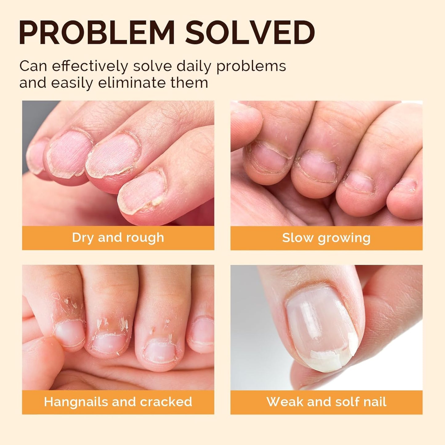 MelodySusie 15Pcs Cuticle Oil Pen Set,Nail Moisturizing Cuticle Oil Enriched with Vitamin E,Softens and Repairs cuticles,Nail Strengthener,Protects Damaged Skin,Thin Nails