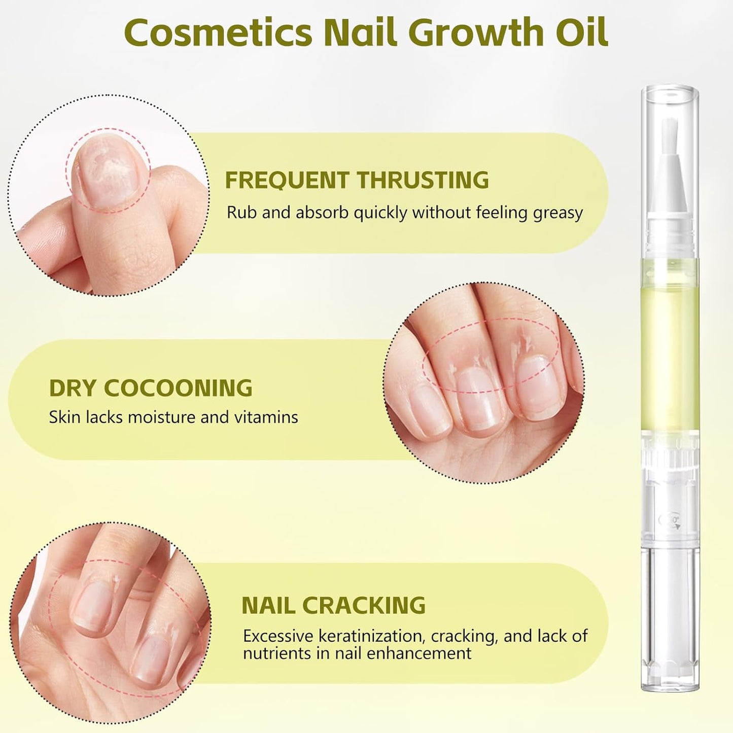 Nailz Nail 𝐆𝐫𝐨𝐰𝐭𝐡 Pen,Radiant Nail Growth GIL,Radiant Nail Growth Oil Pen,Cuticle Oil for Nails,Nail Strengthener, for Moisturize Strengthen Nail Care,Finger Edge Manicure Nourishing Pen(4PCS)