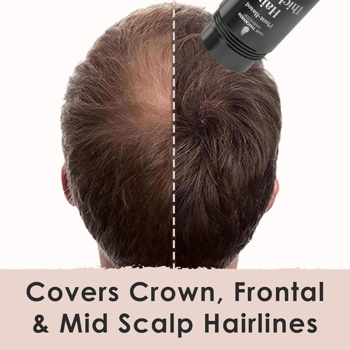 Hair Fibers for Thinning Hair For Women, Men. Plant-Based Formula for Instant Hairline & Bald Spot Coverage. Non-Itchy, Easy to Wash Out (Medium Brown)