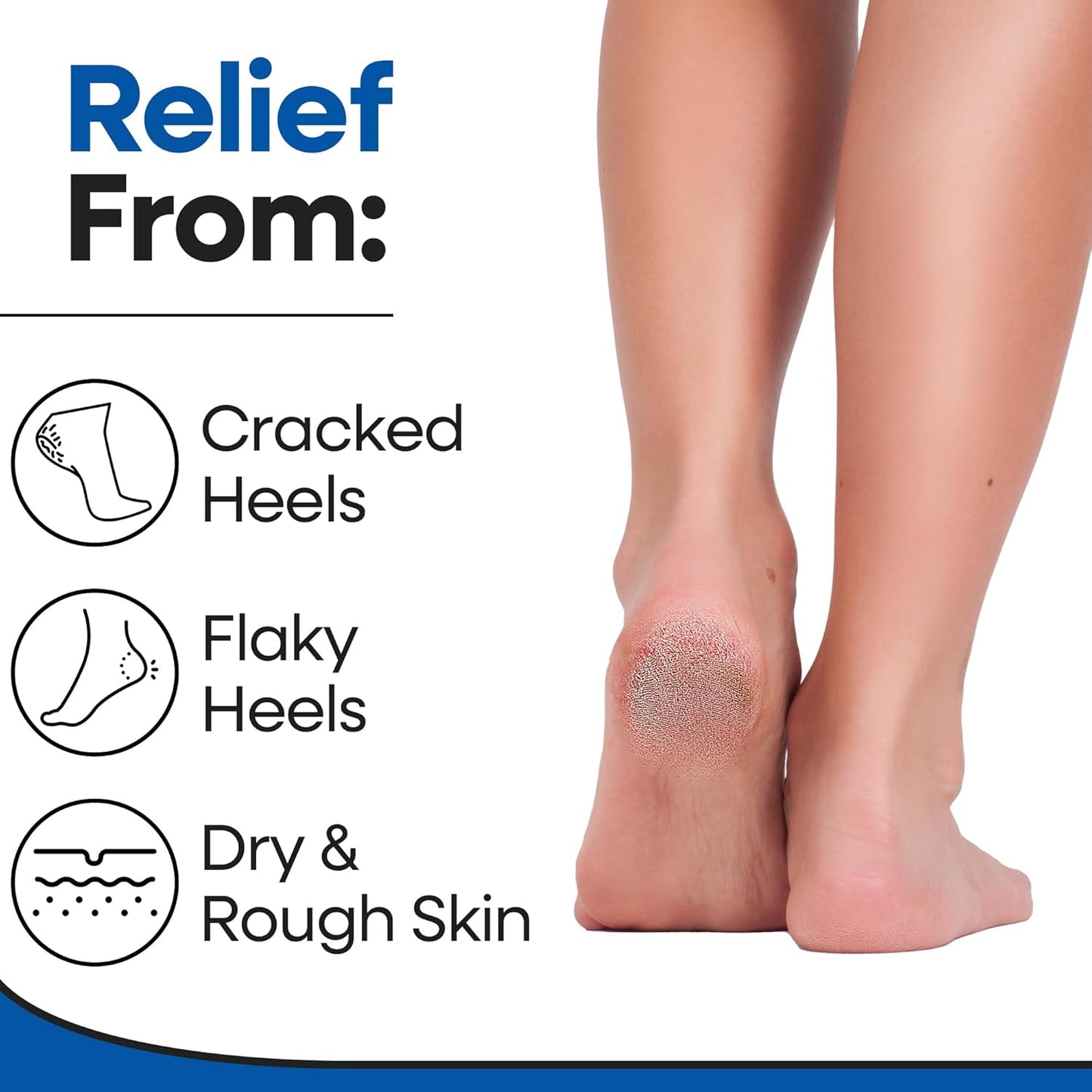 Moisturizing Socks for Women & Men | Aloe Vera Cracked Heel Treatment | Foot Callus Remover | Aloe Socks for Cracked Heels & Dry Cracked Feet | Lotion Infused Gel Heel Socks (Fits Most - 2 Pairs)