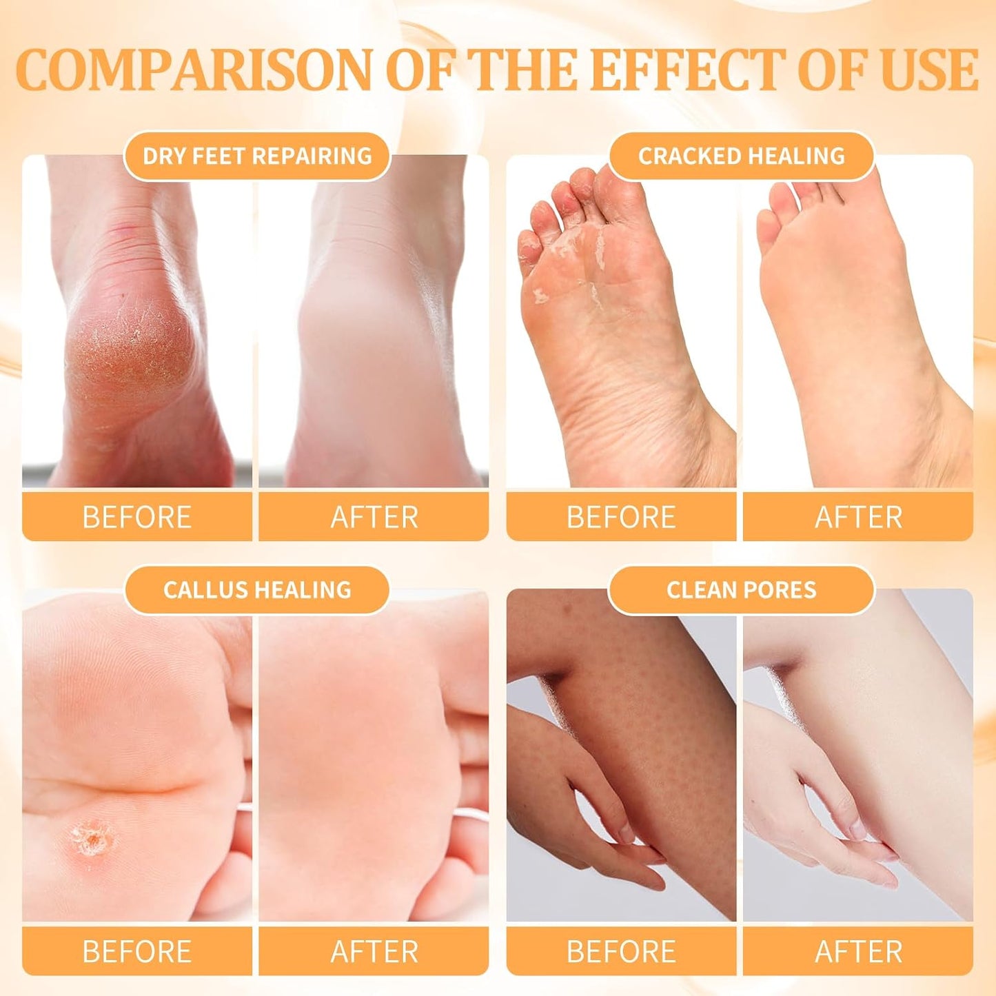 Pedicure Kit Foot Soak Set: Bubble Salt, Sugar Scrub, Massage Mask, Massage Lotion in a Box, 4 Step Foot Spa Kit for Dry Feet, Softens Calluses and Tired Feet（1 Set Orange)