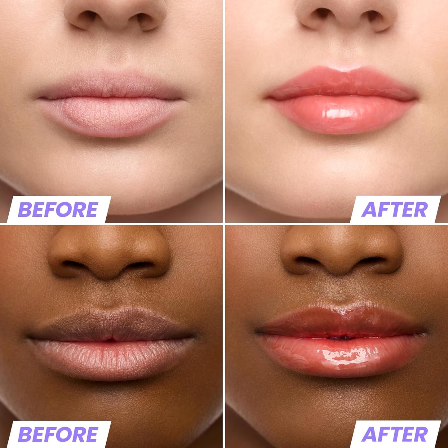 Wonderskin Lip Oil Rehab Serum - Tinted Lip Oil for Women, Hydrating, Moisturizing, and Non-Sticky Bright Red Tint Serum for Dry Lips (Flirt)