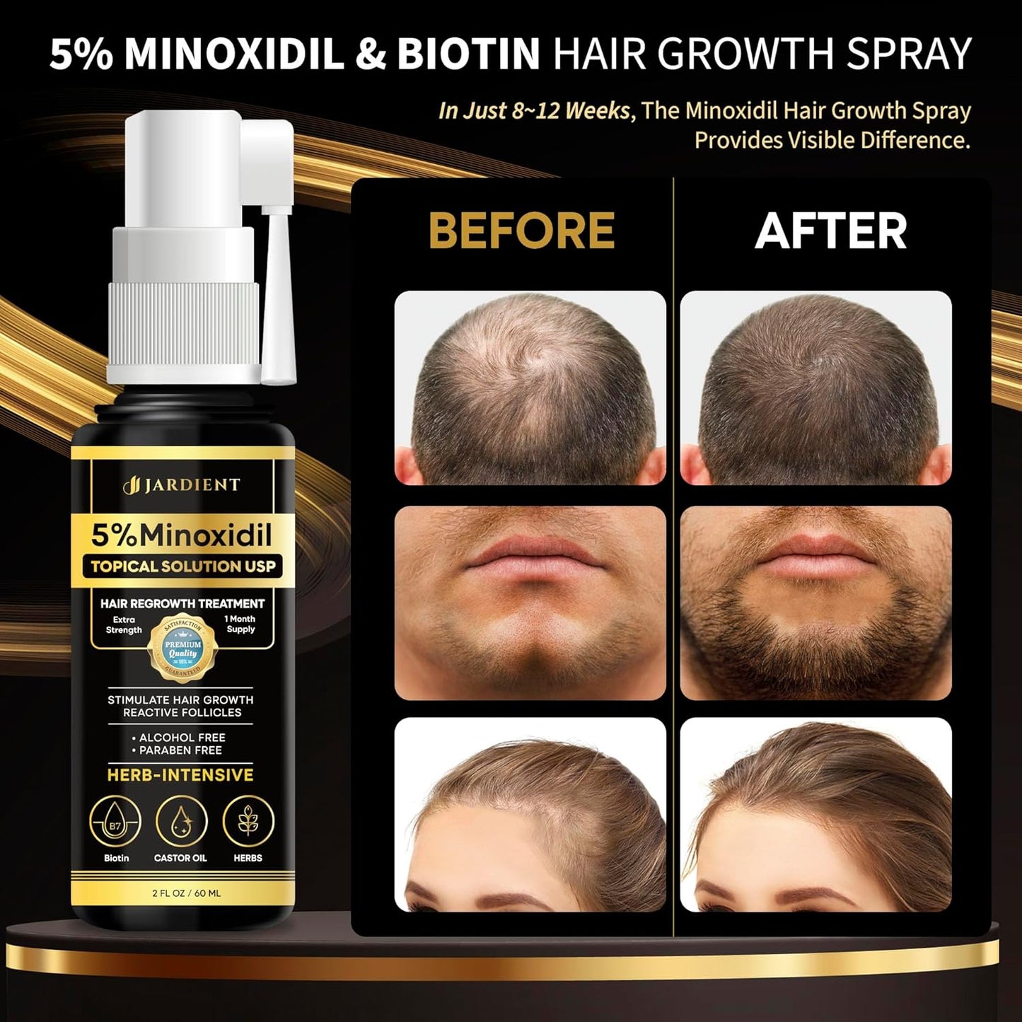 Minoxidil for Women 5 Percent: 5% Minoxidil for Men Beard Growth Spray Infused with Biotin - Extra Strength Hair Regrowth Treatment for Stronger and Longer Hair 2 Fl Oz