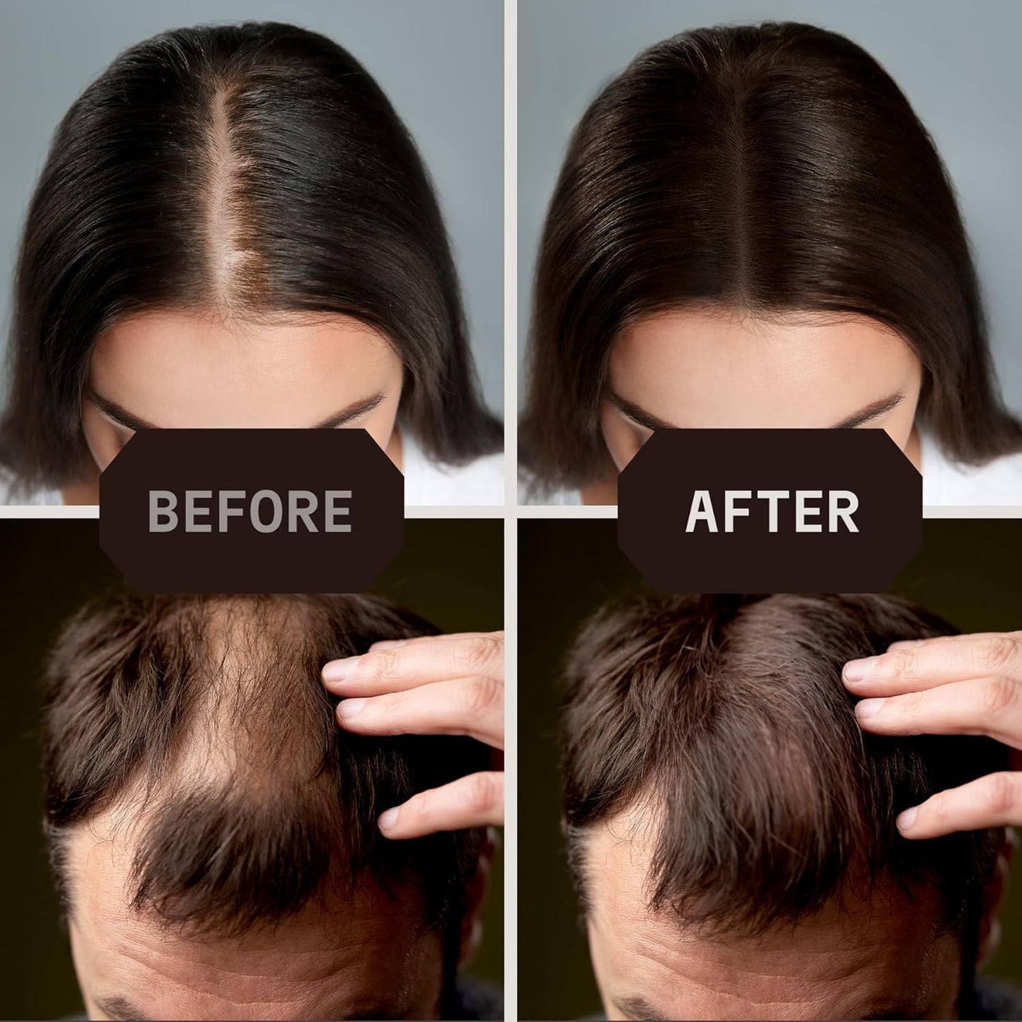 Striking Viking Hair Fibers - Dark Brown, 0.98 oz, Pack of 1 - Long-Lasting Hold & Hair Filler - Undetectable Coverage with Fiber Powder - Easy Application & Styling Powder