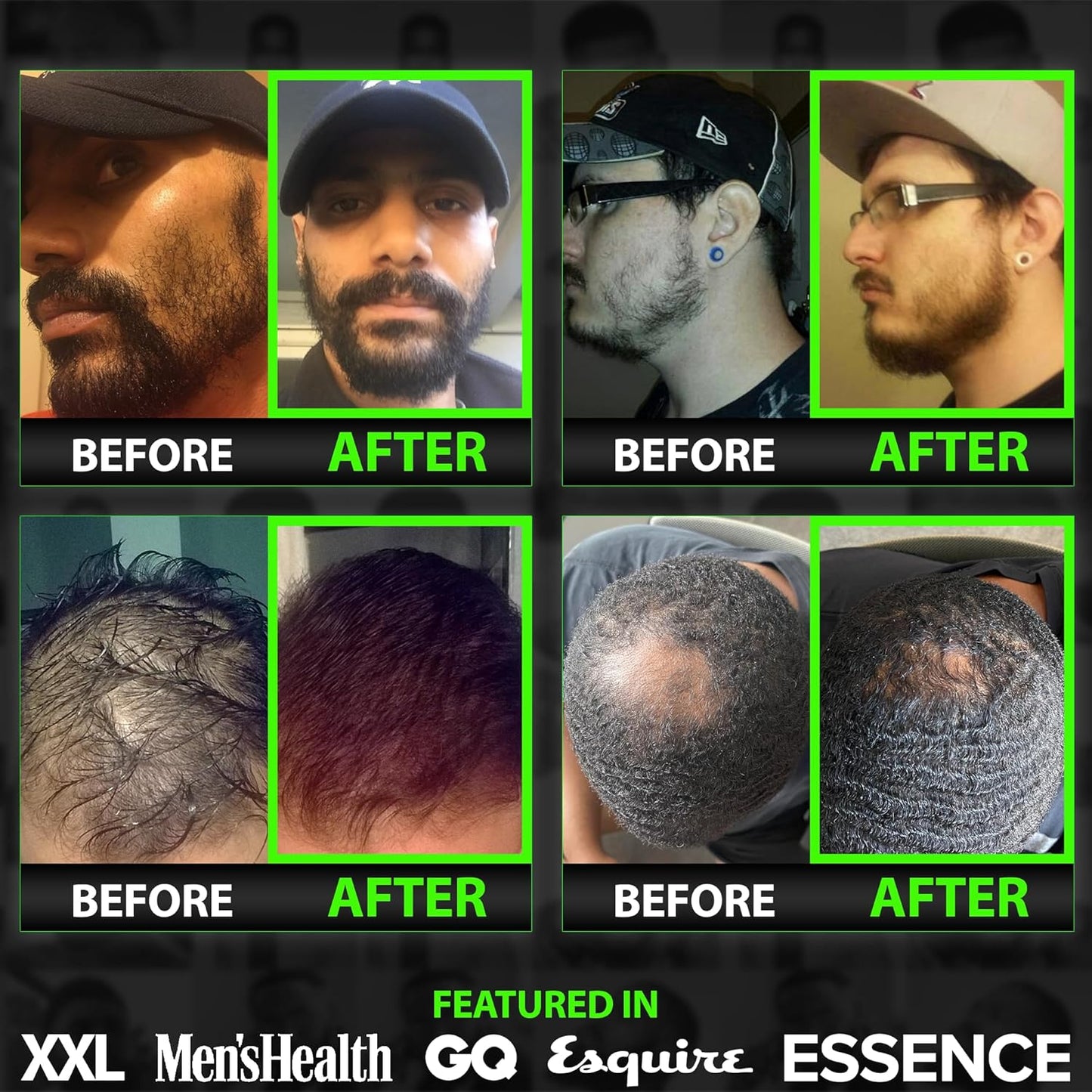 Beard Growth Kit w/ 2X Thickening Biotin Beard Balm for Men & Mustache Wax + GROW Maximum Strength Biotin 11-in-1 Hair Growth Shampoo and Conditioner for Men - Formulated in the USA