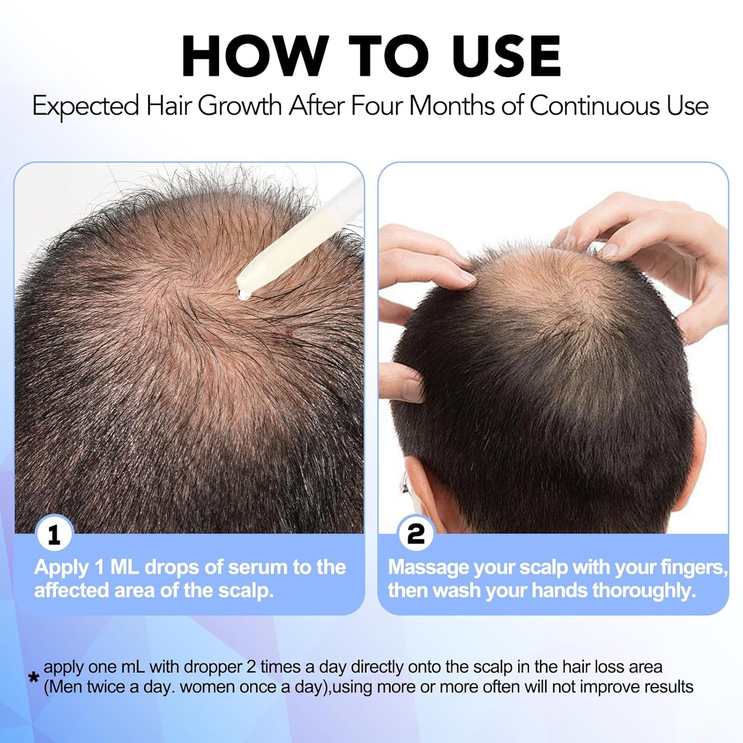 Minoxidil for Men-5% Extra Strength Hair Regrowth for Men Treatment-5% Topical Solution-Dropper Applicator Included -Minoxidil for Women-Stop Thinning & Hair Loss (1pcs